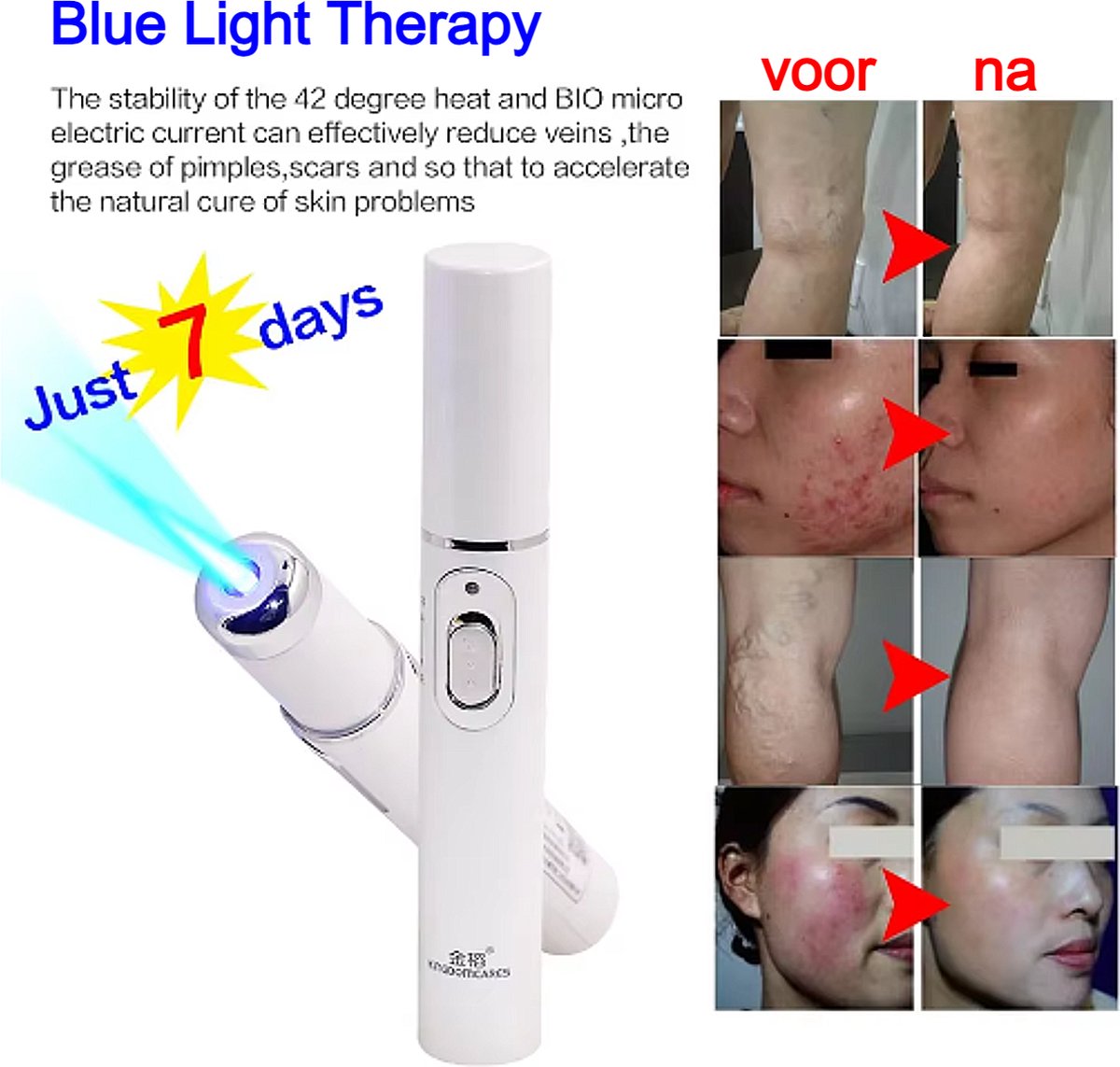 Latest.co.uk® Blue Light Face Laser Pen - Fjerning av kviser og rynker + hudforyngelse ##.