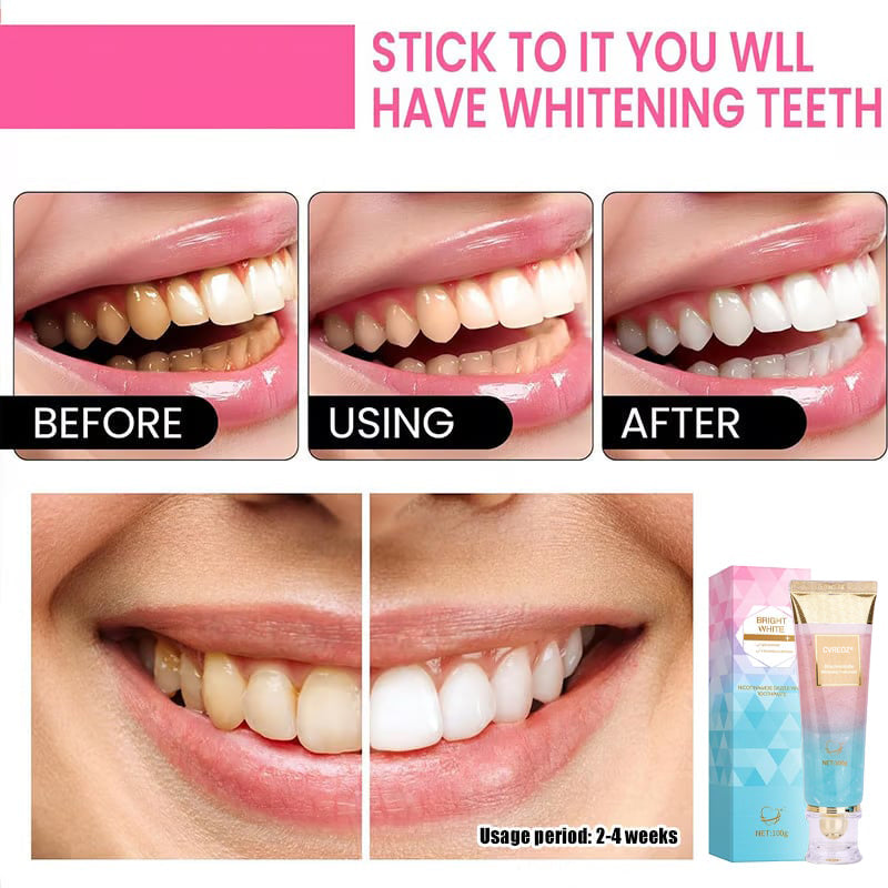 ⚡️Final Day 50% Rabatt: Niacinamid Whitening Toothpaste-max (👄Effektiv på en uke 丨Tripel Whitening & Tannflekkfjerning)