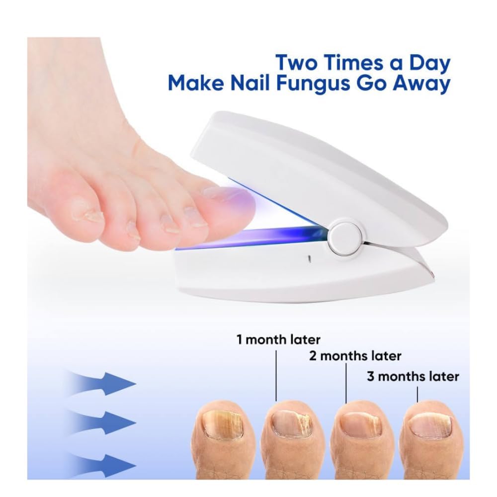 NailHeal Pro™ - Behandlingsapparat for neglesopp 🔥50% Rabatt