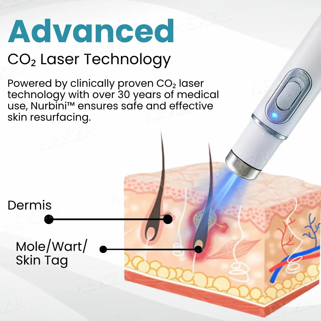 Latest.co.uk® Blue Light Face Laser Pen - Fjerning av kviser og rynker + hudforyngelse ##.