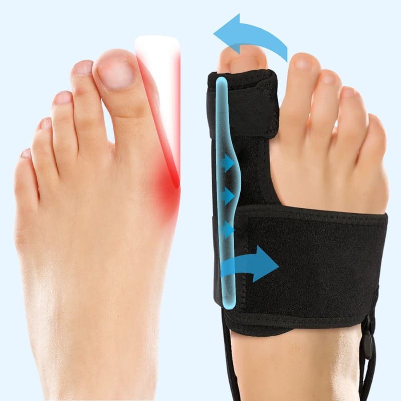 Valgux™ Brace | Tåkorrektor ved skjevstilling (Hallux Valgus) nå med 50 % rabatt 🔥