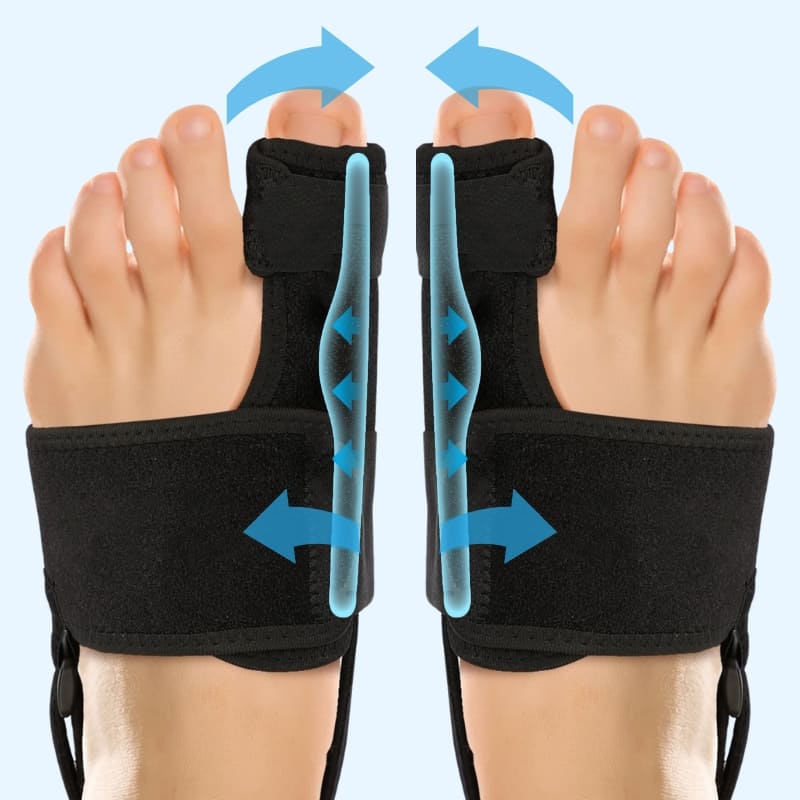 Valgux™ Brace | Tåkorrektor ved skjevstilling (Hallux Valgus) nå med 50 % rabatt 🔥