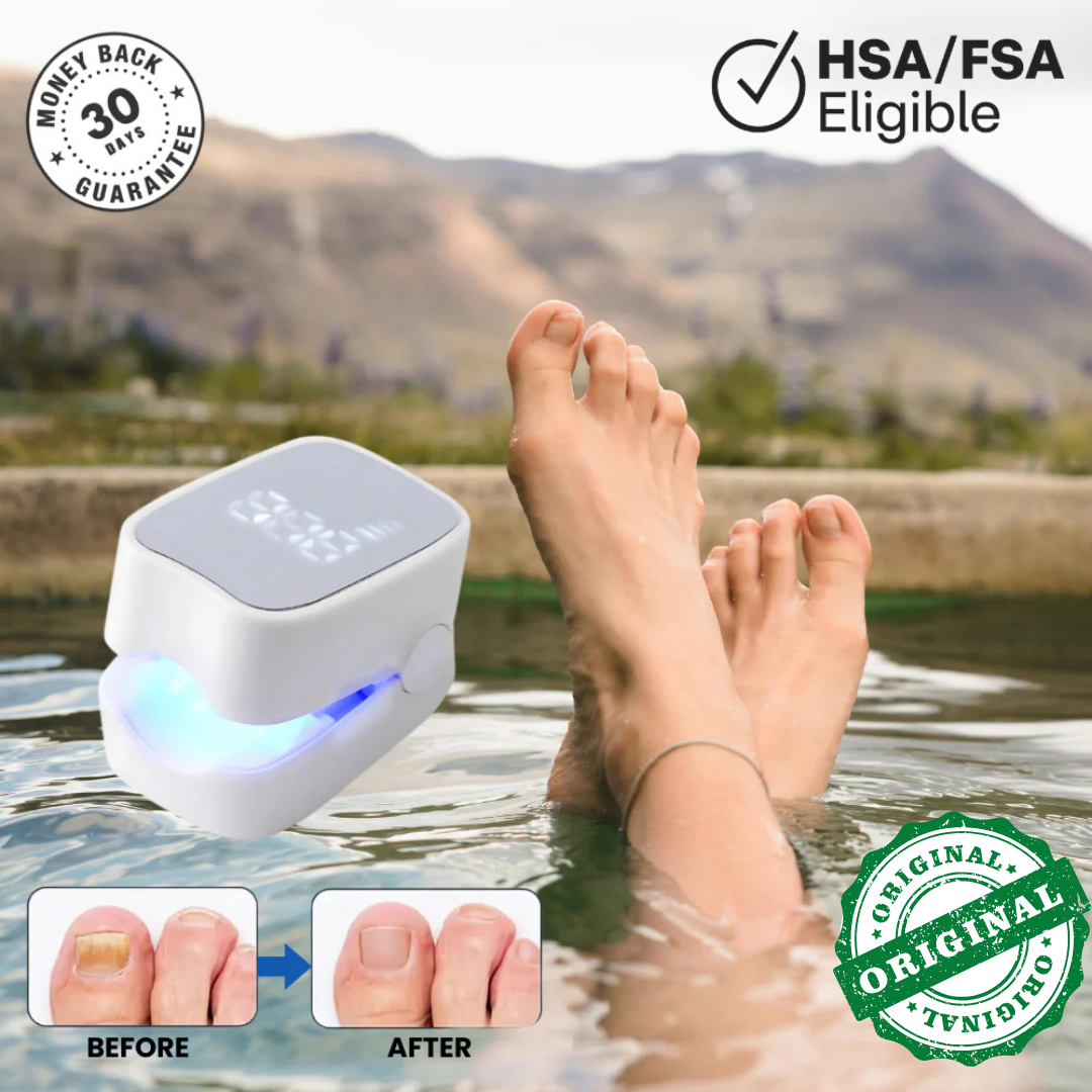 NailHeal Pro™ - Behandlingsapparat for neglesopp 🔥50% Rabatt