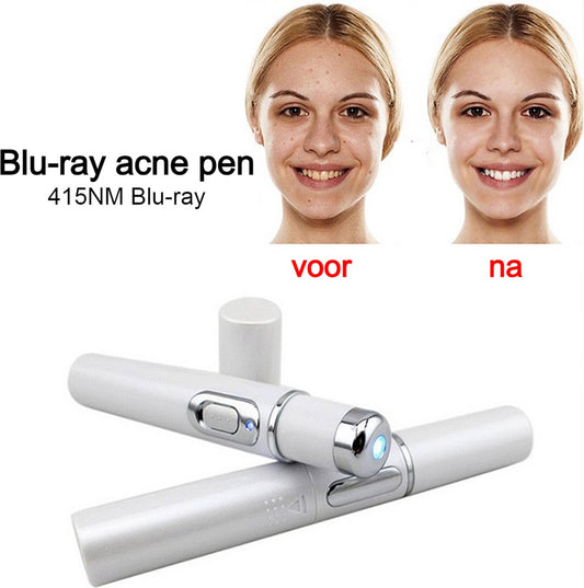 Latest.co.uk® Blue Light Face Laser Pen - Fjerning av kviser og rynker + hudforyngelse ##.
