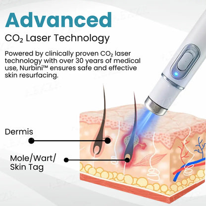 Latest.co.uk® Blue Light Face Laser Pen - Fjerning av kviser og rynker + hudforyngelse ##.